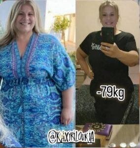 αποτέλεσμα απώλειας βάρους πριν και μετά με πρόγραμμα διατροφής